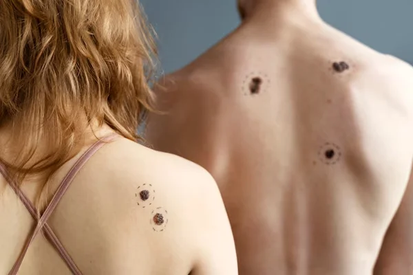 Moles